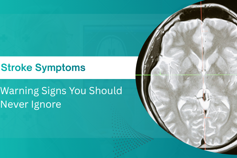 stroke symptoms